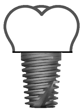 Imagen de Implantología en la Clínica Dental Oíza-Colera