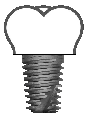 Imatge d'implantologia a la Clínica Dental Oíza-Colera