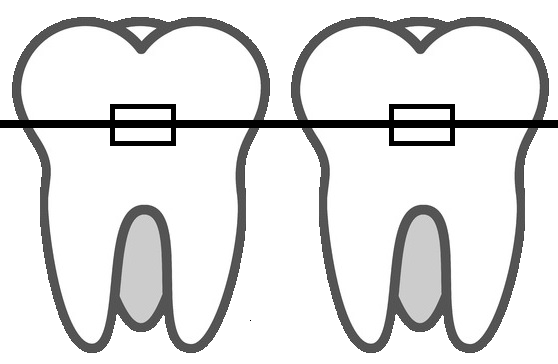 Imatge d'ortodòncia a la Clínica Dental Oíza-Colera